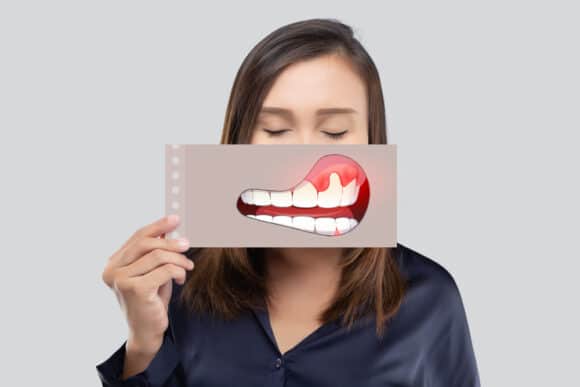 What to Do When Dental Pain Strikes