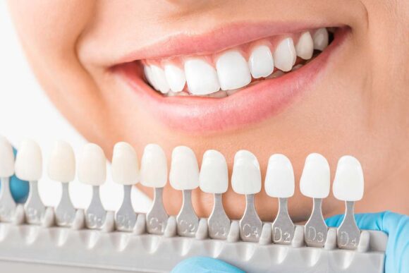 Choosing The Right Cosmetic Dentistry Procedure For Your Needs