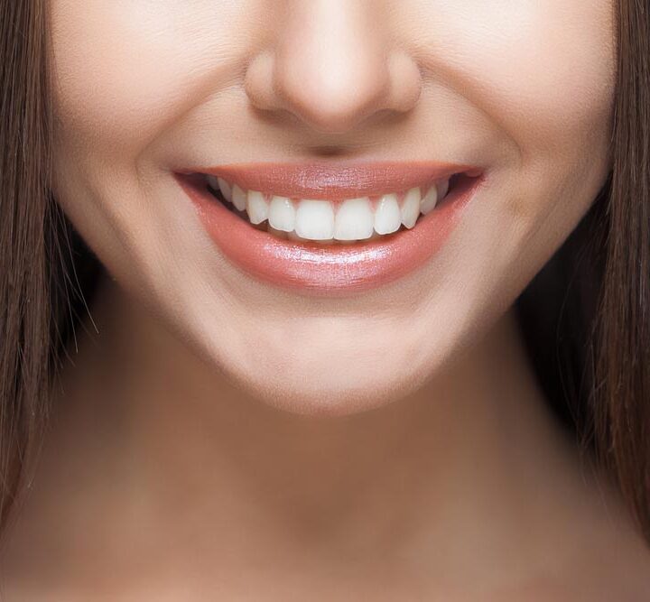 Woman With White Teeth